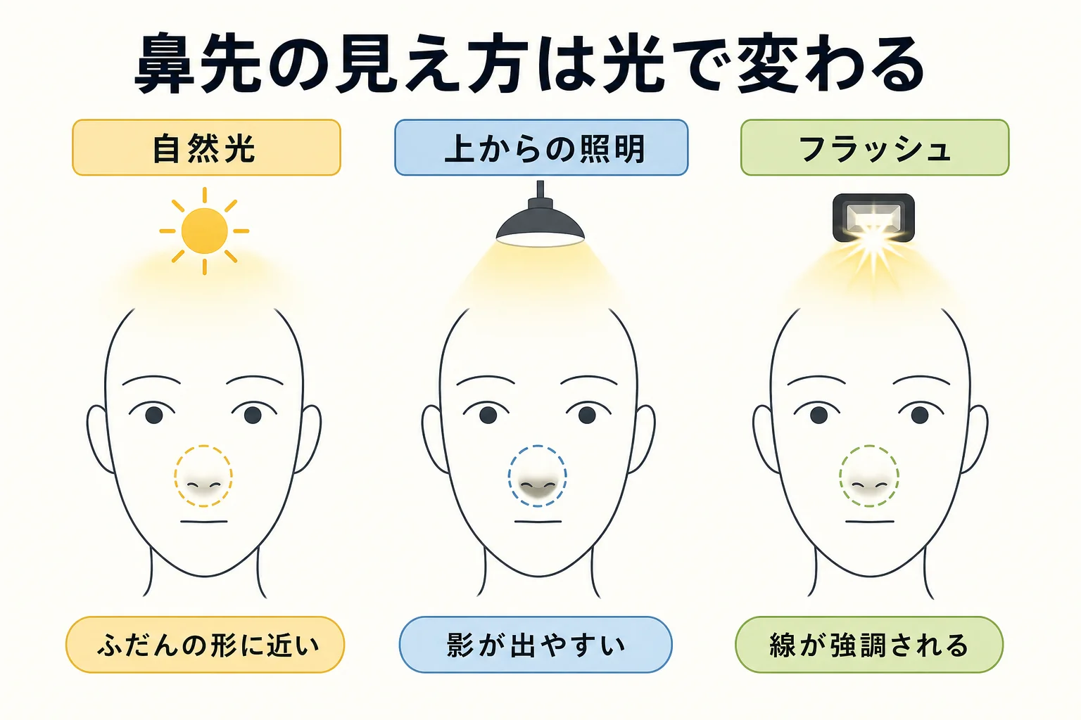 鼻先が割れて見える形と光の当たり方の違いを簡略な線画で示した図解