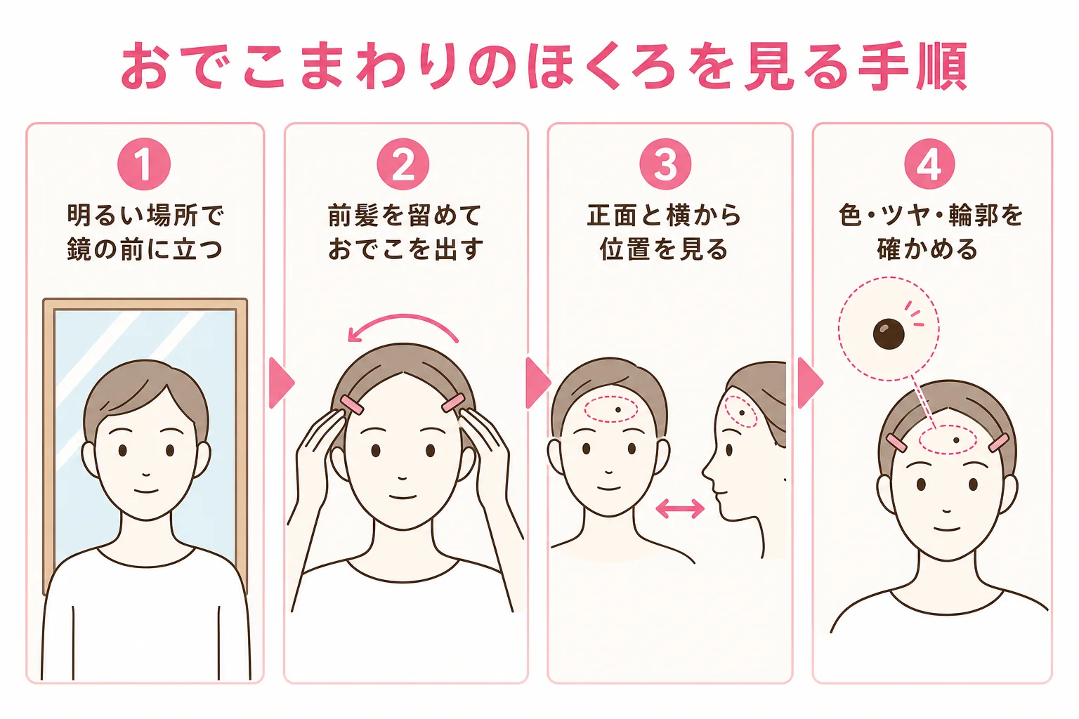 前髪を上げて、正面と横からおでこまわりのほくろを確かめる手順を示した図解