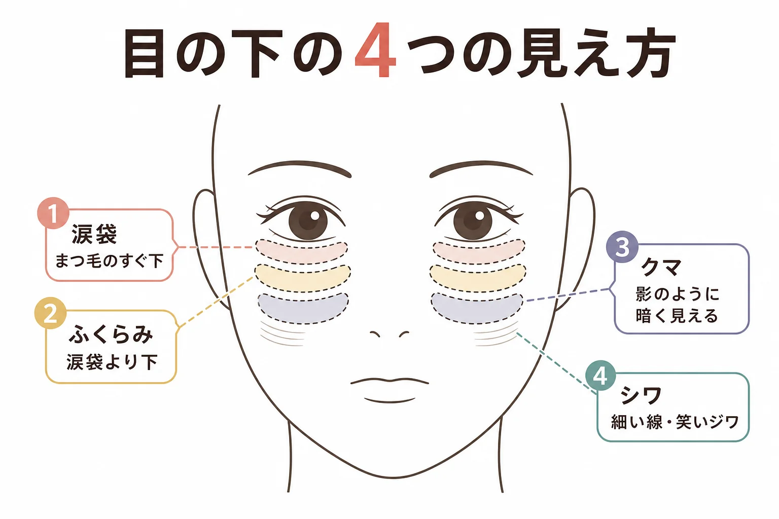 目の下の涙袋・ふくらみ・クマ・シワの位置を正面顔の線画で示した図解